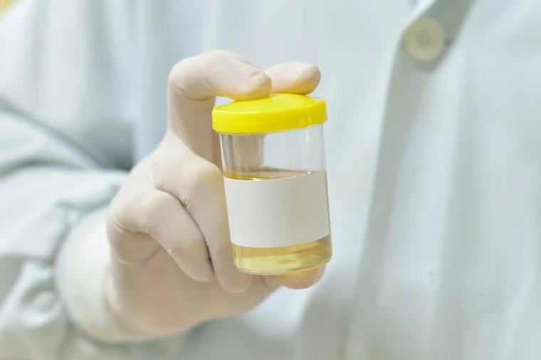 Test GALEAS Bladder wykrywa raka pęcherza z 92-procentową skutecznością